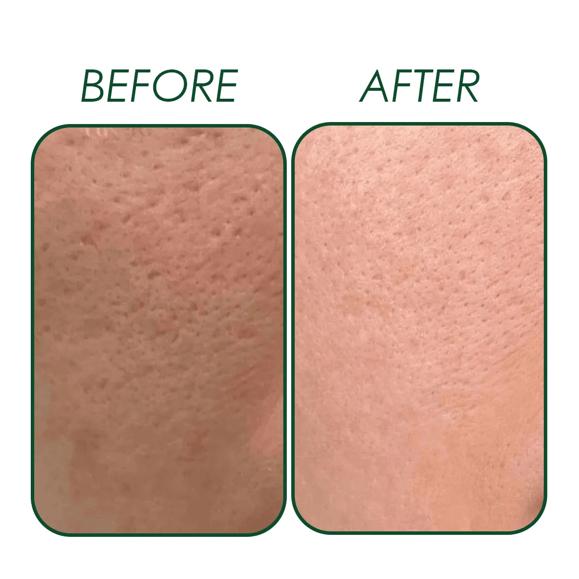 Niacinamide 10% Serum - photo 3